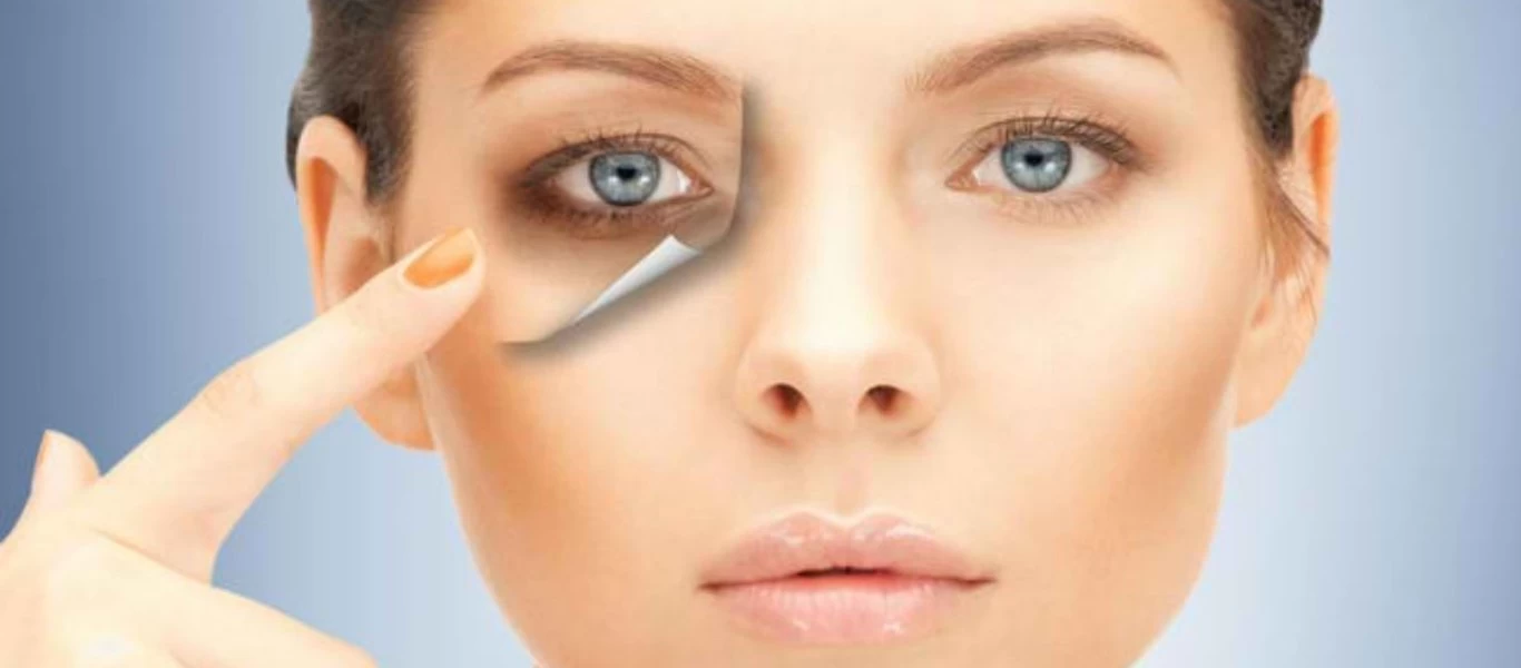 Τα μυστικά για να αποχαιρετήσετε τους μαύρους κύκλους μία για πάντα